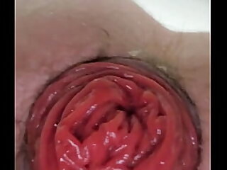 Gaping